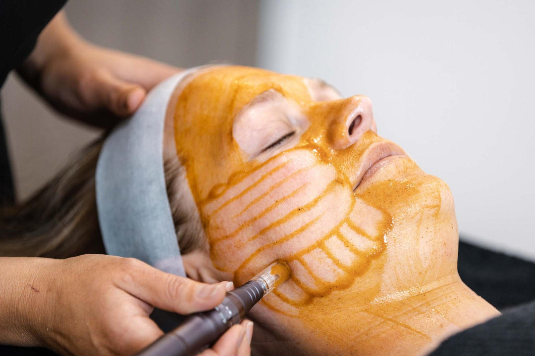 Elevate Your Skincare with RevitaPen Pro's Innovative Infusion