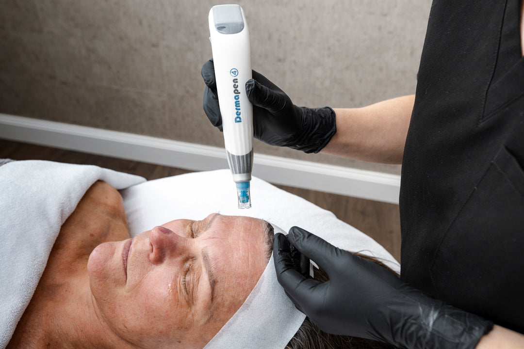 6 x Skin Needling Treatments